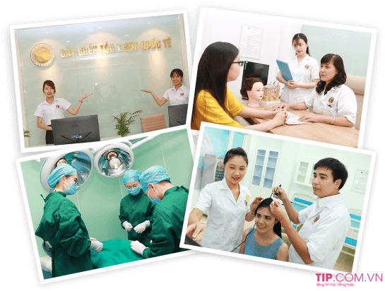 Điều trị rụng tóc hiệu quả nhất 2020