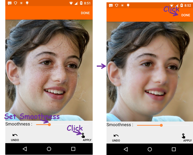 Face Acne Remover Photo Editor App Face Acne Remover Photo Editor App