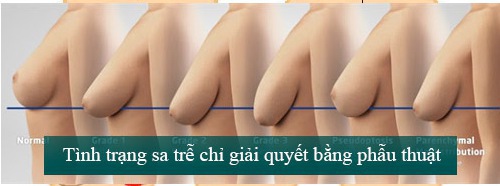 imager_13_3818_700 *