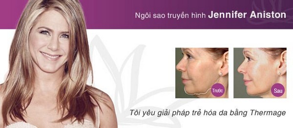imager_5_8684_700 *