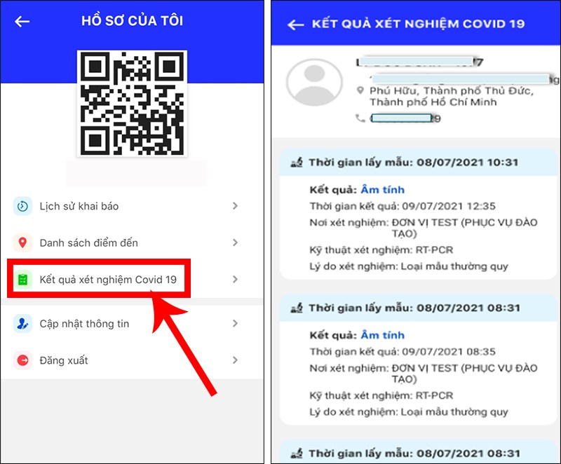 Chọn mục Kết quả xét nghiệm Covid 19 để xem kết quả Chọn mục Kết quả xét nghiệm Covid 19 để xem kết quả
