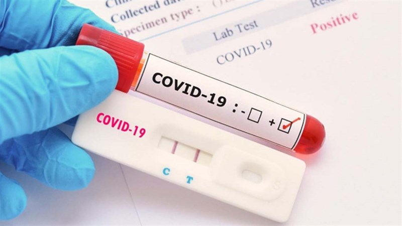 Có nên mua bộ kit test nhanh Covid-19 qua mạng không? Có nên mua bộ kit test nhanh Covid-19 qua mạng không?